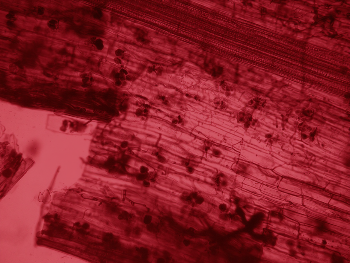 microscopic mycorrhiza